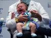 Aid cuts, misinformation threaten child vaccination progress: UN